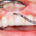 Top Dental colleges in Udaipur
